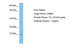 CRYBA1 Antibody, Novus Biologicals 100 &mu;L; Unconjugated:Antibodies,